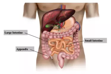 best hospital for appendix surgery in Purnia, best doctor for appendix treatment in Purnia, cost of appendix surgery in Purnia